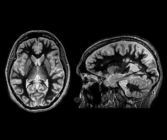 Brain