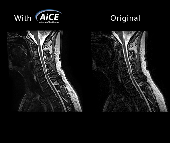Fast3D + AiCE – Maximum Quality, Minimum Time