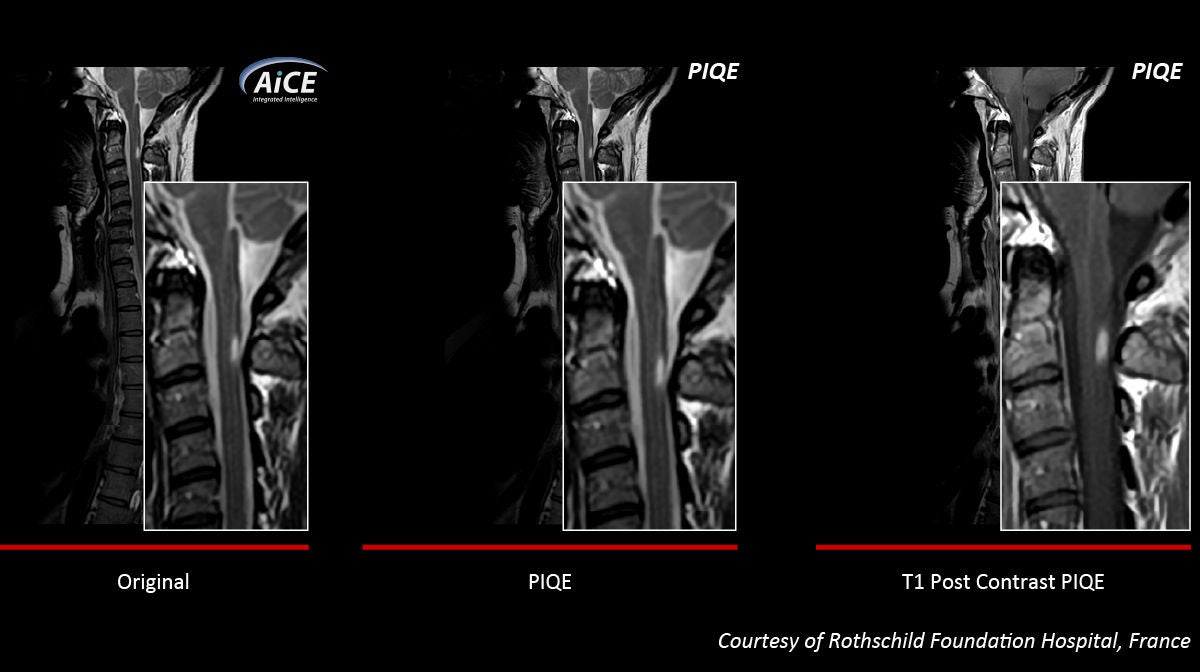 Key Clinical Imaging Tips for V9.0 PIQE Validation Sites in Europe