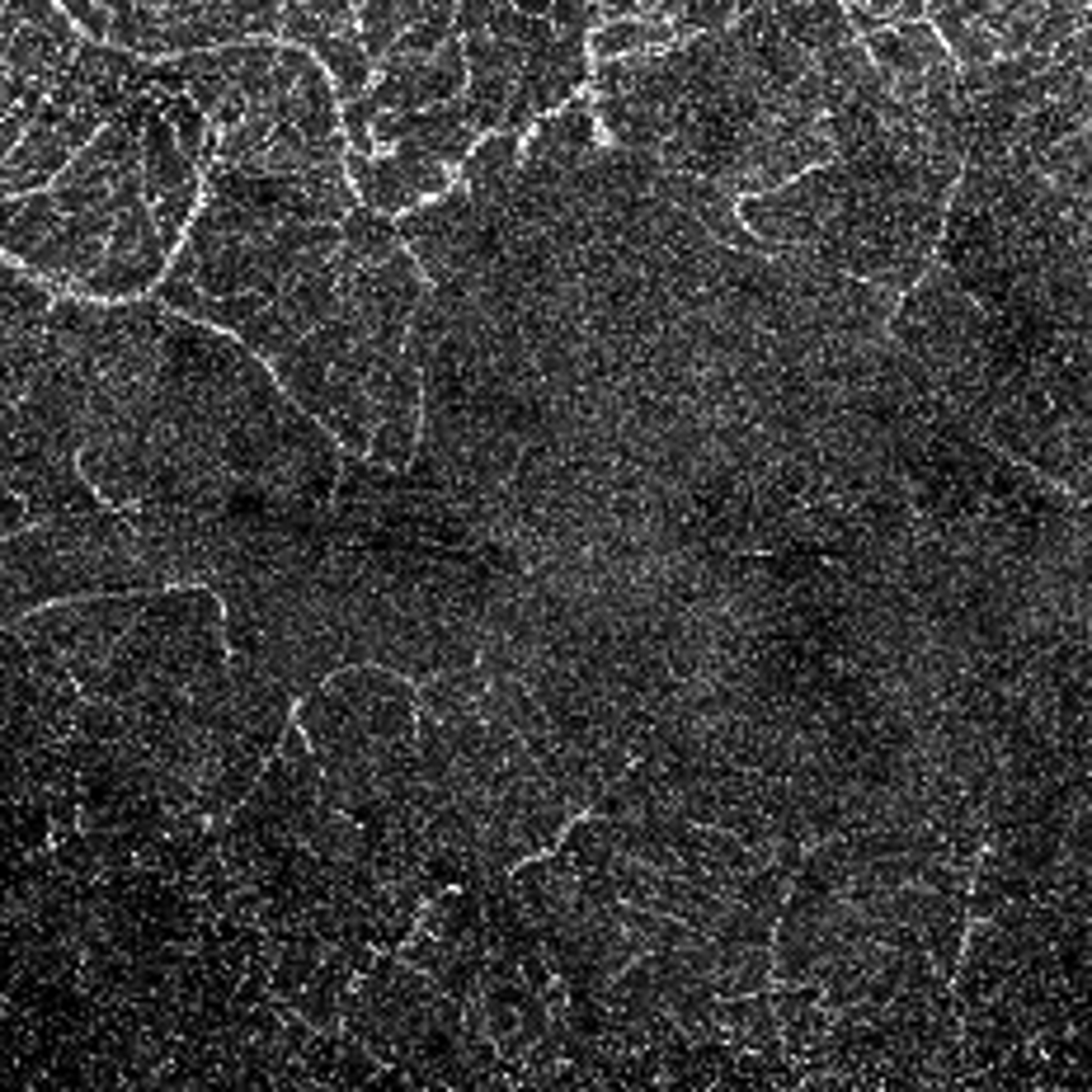 Behcet's disease