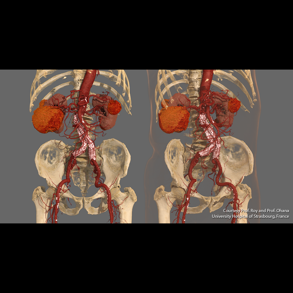 Abdomen