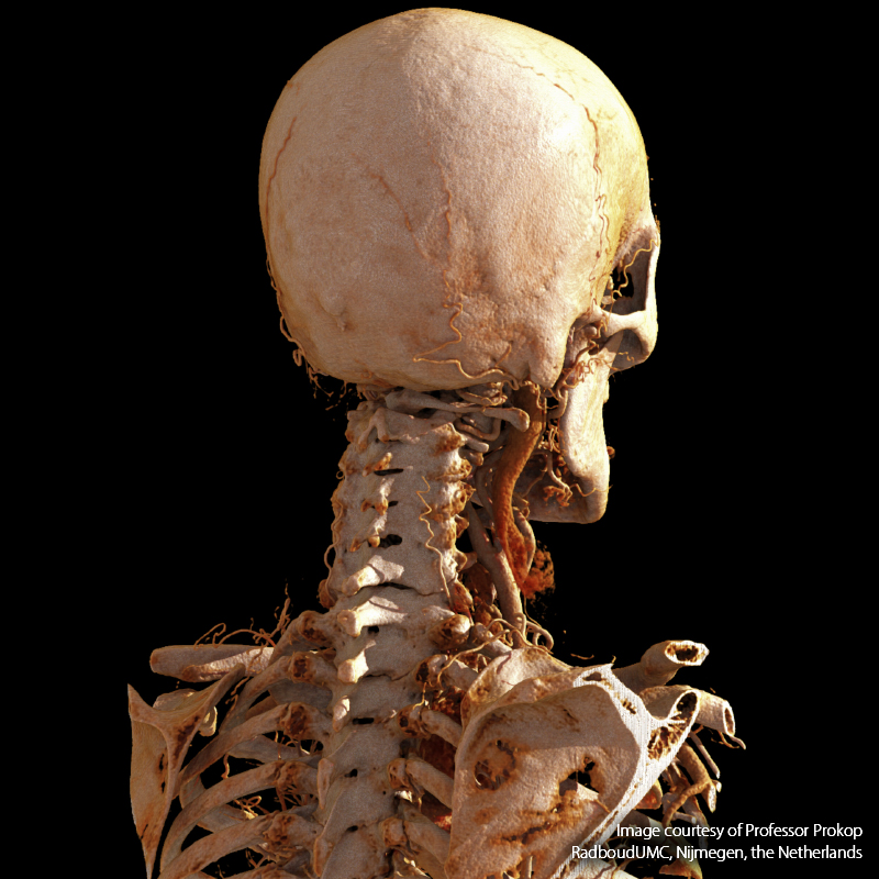 Neck
